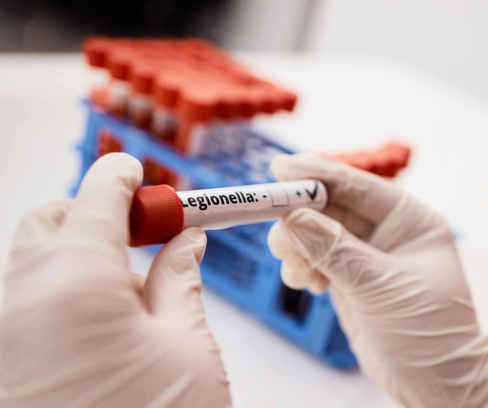 Blood, results or hands of scientist with vaccine in science laboratory with innovation, dna and rn